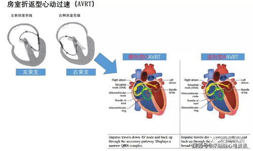 心電圖基礎知識網(wǎng)頁(yè)