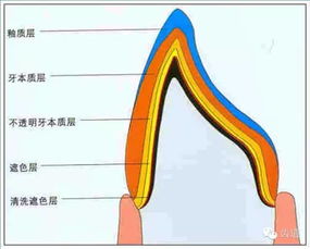 牙體預備的基礎知識